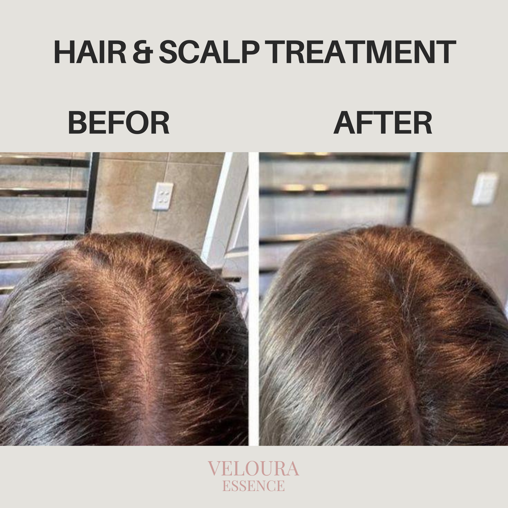 Hair & Scalp Treatment