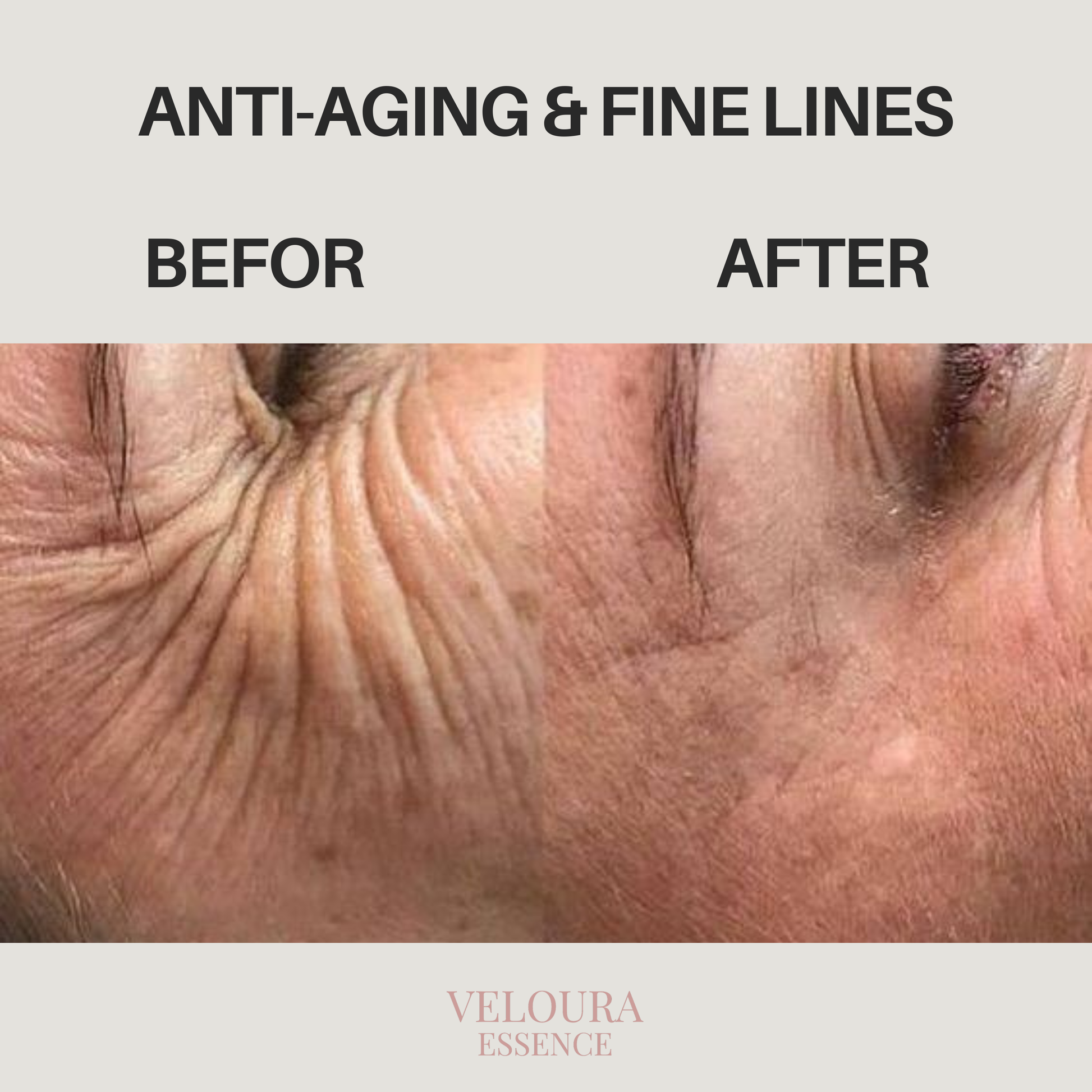Anti-Aging & Fine Lines