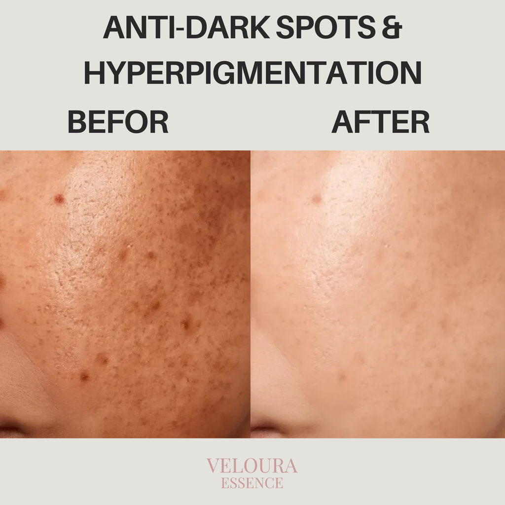 Anti-Dark Spots & Hyperpigmentation