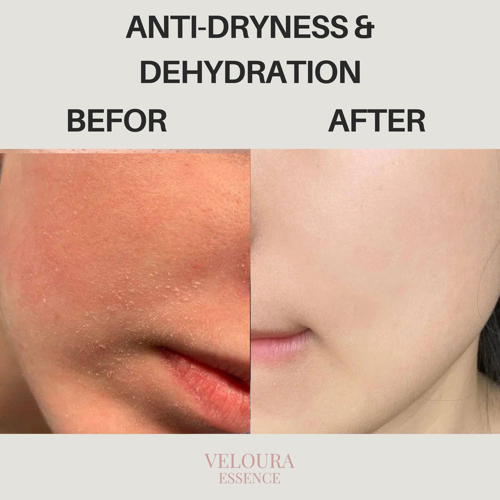 Anti-Dryness & Dehydration