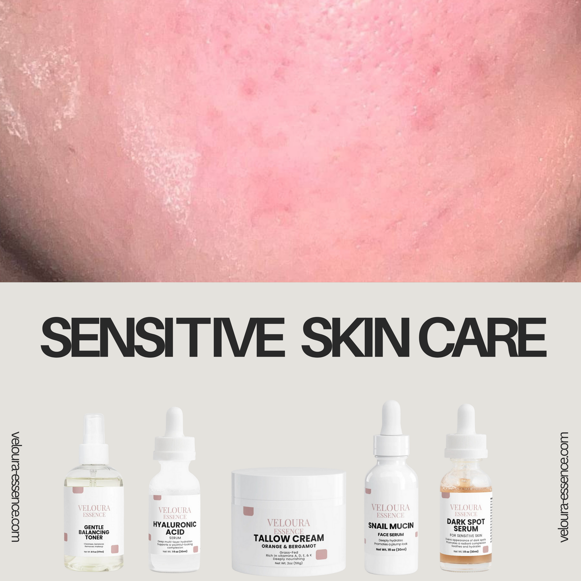 Sensitive & Irritated Skin-care