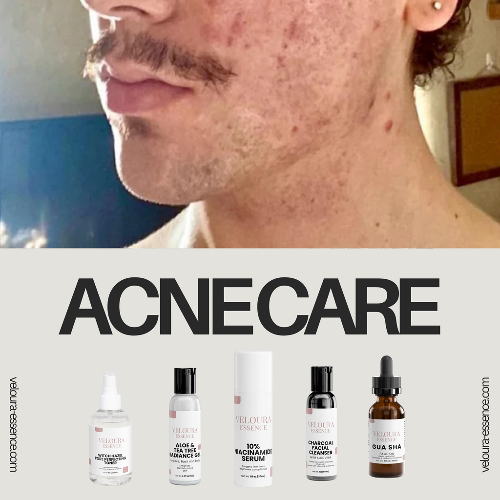 Anti-Acne & Blemishes